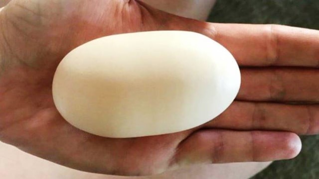 Telur 'raksasa' dari ayam (Foto: Graaa/reddit)