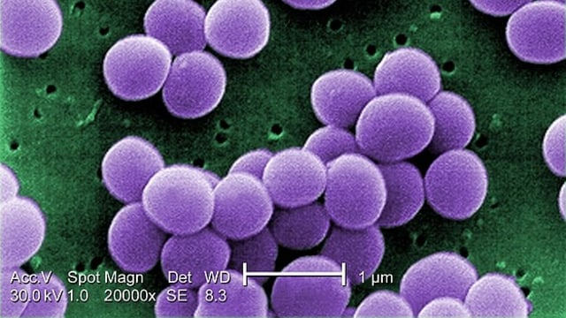 Bakteri Staphylococcus aureus. (Foto:  Centers for Disease Control and Prevention)