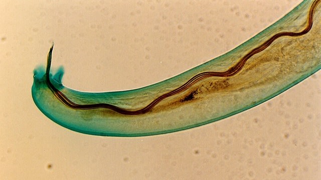 Cacing parasit Angiostrongylus cantonensis. (Foto: Punlop Anusonpornperm via Wikimedia Commons)