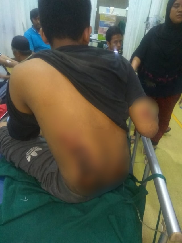 Korban kecelakaan yang ditabrak bocah 13 tahun di Jakarta Barat. (Foto: Dok Istimewa)