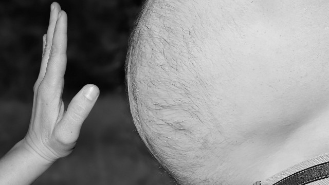 Ilustrasi perut buncit seorang pria AS yang ternyata tumor 33 kilogram. (Foto: Tumisu via pixabay)