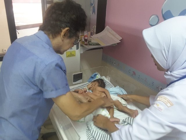 RSHS Tangani Bayi Kembar Dempet Dada dan Perut Asal Cirebon
