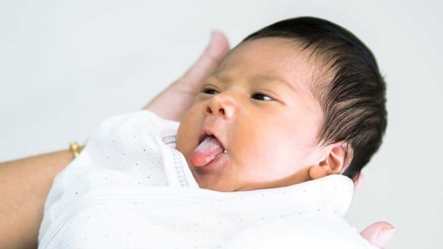 Berbahayakah Geographic Tongue?