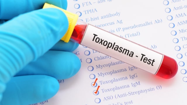 Ilustrasi pemeriksaan toksoplasma sebagai bagian dari TORCH (Foto: Shutterstock)
