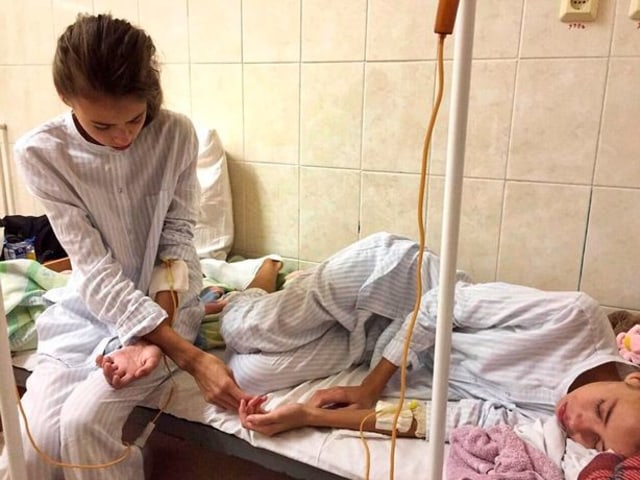 Model Remaja Kembar Asal Rusia Ini Sekarat karena Terlalu Kurus (1)