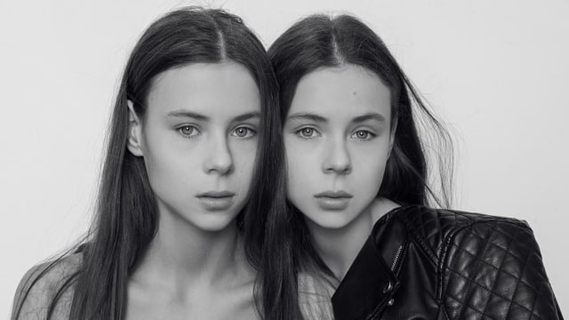 Model Remaja Kembar Asal Rusia Ini Sekarat karena Terlalu Kurus