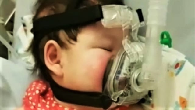Baby Kimberly dirawat di KK Hospital Singapura. (Foto: Dok. Kitabisa.com)