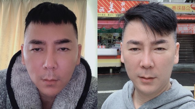 Addy Lee, hairstylist Singapura yang gagal menjalani operasi plastik di Korea Selatan. (Foto: dok. Instagram Addy Lee)