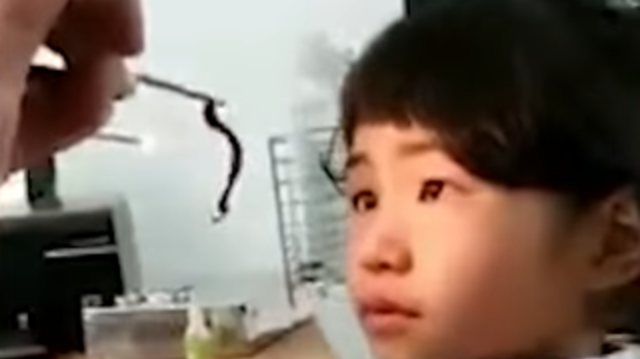 Cacing 8 Cm Bersarang Sebulan Lebih di Hidung Gadis Kecil di Vietnam (1)