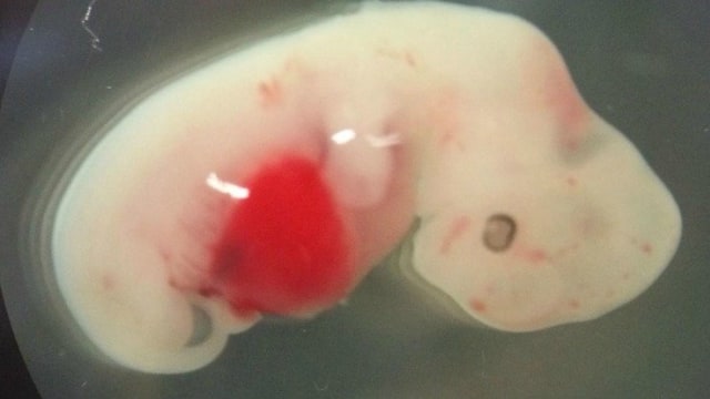 Embrio babi yang disuntikan sel manusia. (Foto: Juan Carlos Izpisua Belmonte)
