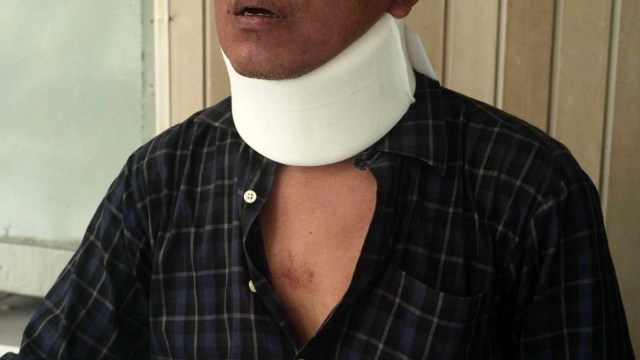 Ali Wardi korban pengeroyokan di DPP PBB. (Foto: Irfan Adi Saputra/kumparan)