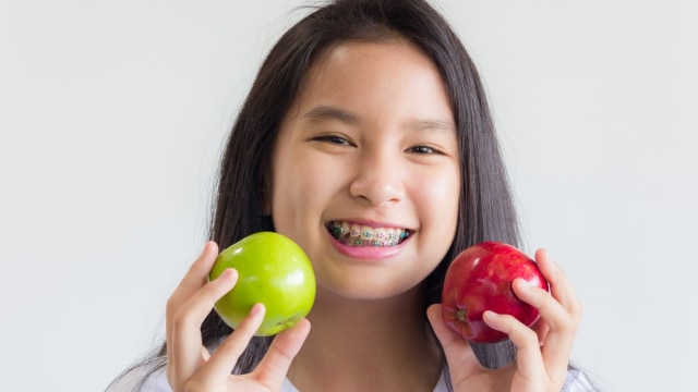 Ilustrasi anak menggunakan kawat gigi Foto: Shutter Stock