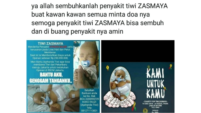 Usai Liver, Dokter Kini Vonis Bayi 8 Bulan di Riau Ini Gizi Buruk   
