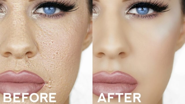 Tips Trik Make Up Untuk Kulit Perawatan Dokter Kumparan Com Tips Trik Make Up Untuk Kulit Perawatan Dokter Kumparan Com