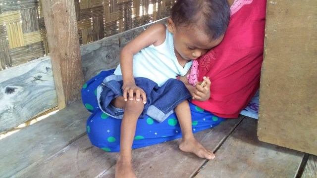 Budi, balita berusia 2,9 tahun yang terindikasi gizi buruk, sedang dipangkuan ibundanya, Kamis (21/03). Foto: Wiwid Abid Abadi/kendarinesiaid
