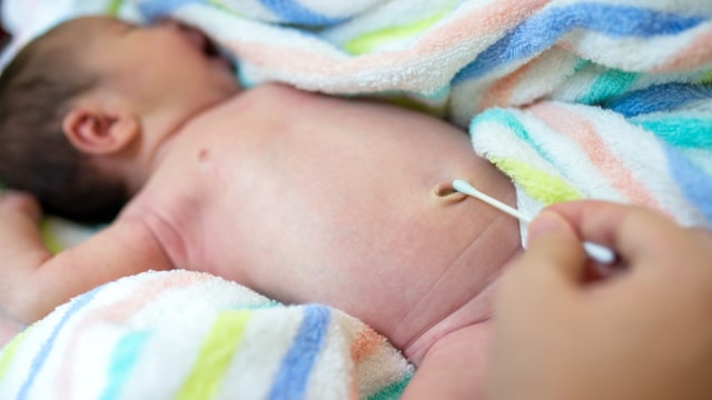 Merawat pusar bayi baru lahir. Foto: Shutterstock