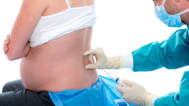 Ilustrasi epidural saat melahirkan. Foto: Shutterstock