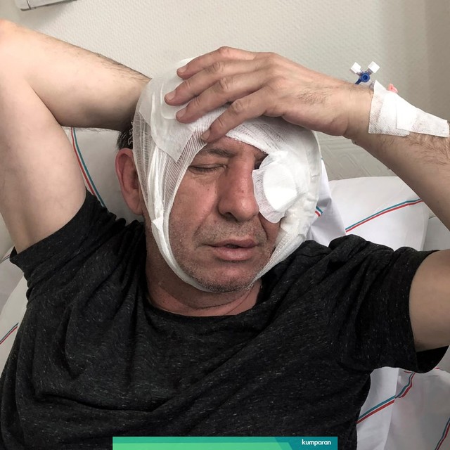 Yavuz Selim Demirag, seorang jurnalis Turki mendapat perawatan di rumah sakit di Ankara, Turki. Foto: AP Photo / Burhan Ozbilici