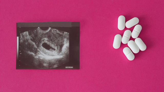 Ilustrasi aborsi. Foto: Shutter Stock