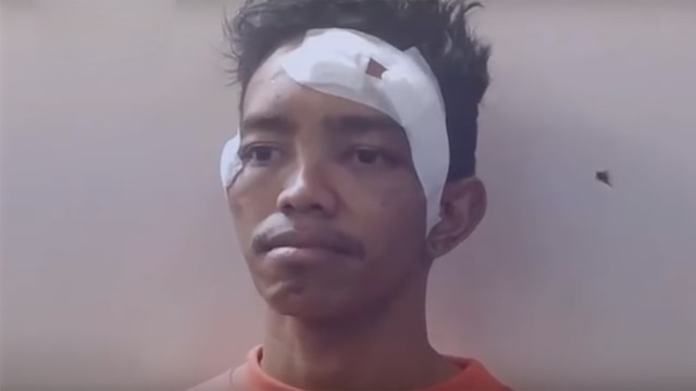 Andri Bibir, sosok yang mengaku sebagai korban pemukulan anggota Brimob. Foto: Istimewa