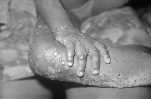 Untitled Image