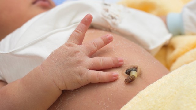 tali pusat atau pusar bayi Foto: Shutterstock