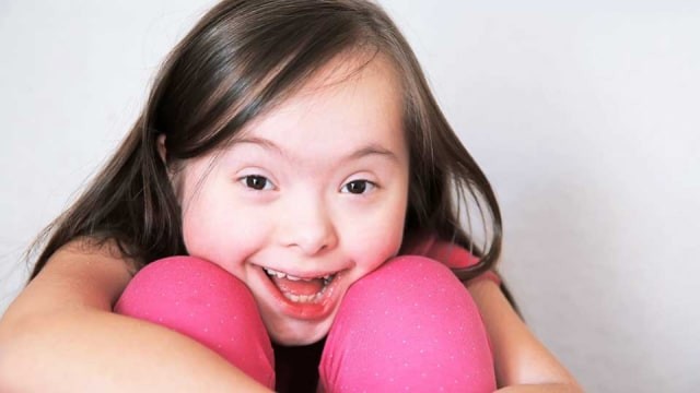 Apa Itu Sindrom Down Kumparan Com