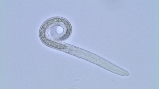 Ascaris larva yang diduga menjadi penyebab sakit perut si wanita. Foto: SuSanA Secretariat via Flickr