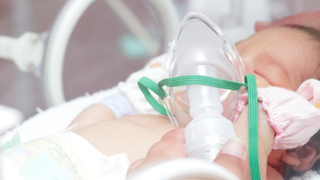 terapi inhalasi pada bayi Foto: Shutterstock