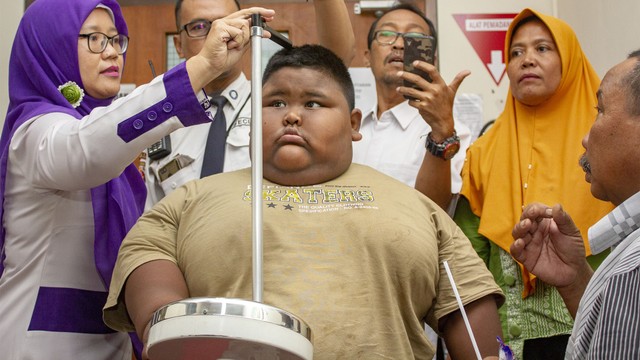 Satia Putra (7) penyandang obesitas dengan berat badan mencapai 101 kg. Foto: ANTARA FOTO/M Ibnu Chazar