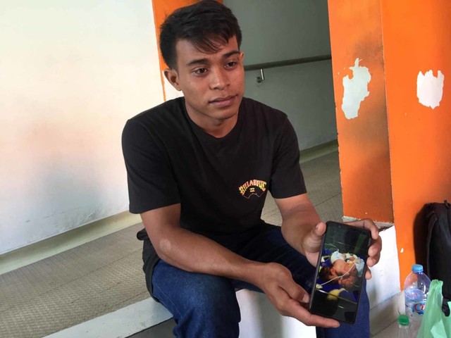 Bayi kembar siam di RSUP Sanglah, Kadek Rudita (NOT COVER)