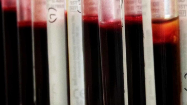 Ilustrasi ambil sample darah. Foto: Aditia Noviansyah/kumparan