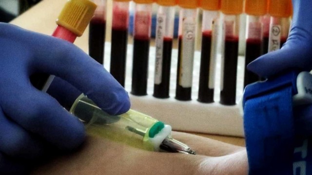 Transplantasi Cairan Vagina, Teknik Baru Atasi Infeksi Berbahaya (109039)
