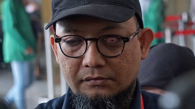 Novel Baswedan: Pak Tito, Kalau Pelaku Tak Terungkap, Keterlaluan (261207)