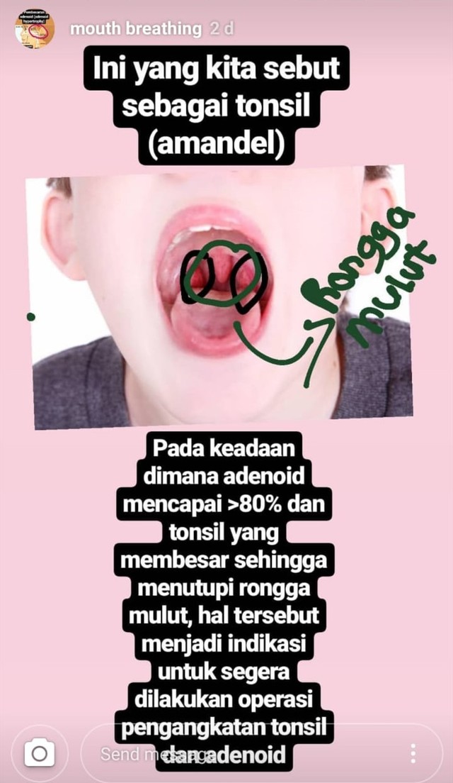 Penjelasan Dewi Boedhiyono terkait blokade pernapasan (NOT COVER)