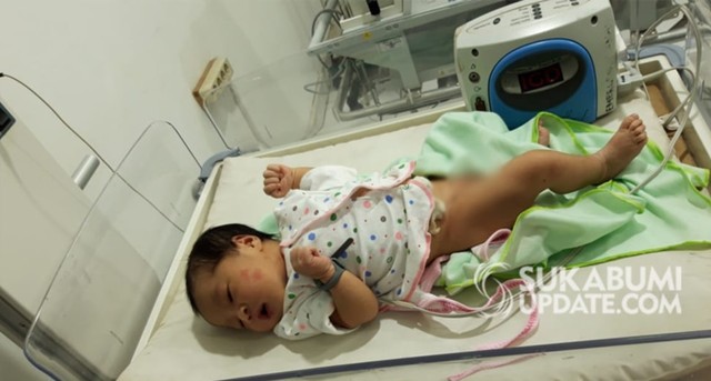 Bayi perempuan yang ditemukan di wilayah Cibeureum, Jumat (12/7/2019) sekitar pukul 24.00 WIB, dan saat ini tengah menjalani penanganan intensif di RSUD Syamsudin SH. | Sumber Foto:Istimewa.