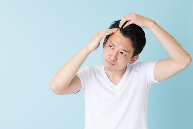 4 Cara Mengatasi Rambut Berketombe pada Pria. Foto: dok.Shutterstock