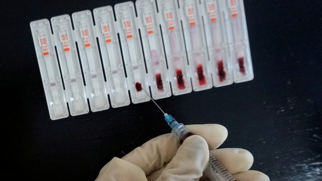Virus HIV Varian Baru Ditemukan, Lebih Cepat Menular dan Berkembang Jadi AIDS (2)