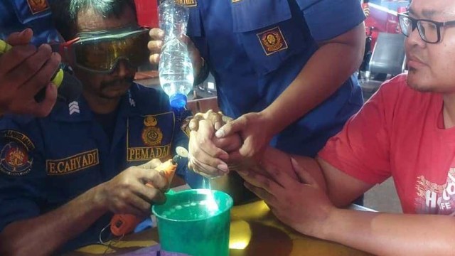 Pemuda di Jaktim Minta Damkar Copot Cincin yang Terpasang 2 Tahun (86761)