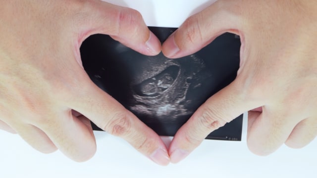 Ilustrasi detak jantung janin dari pemeriksaan USG Foto: Shutterstock