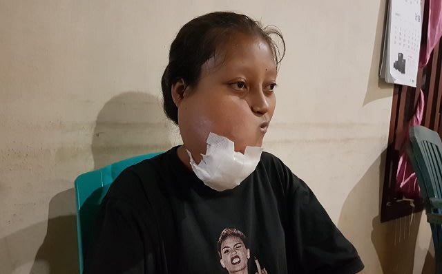 frili pemunda penderita tumor 2.jpg