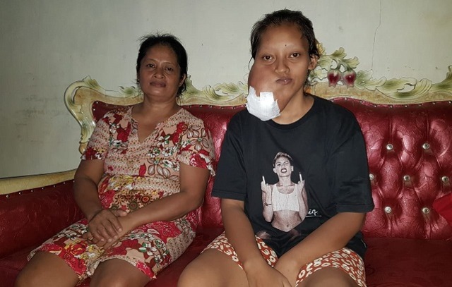 frili pemunda penderita tumor 1.jpg