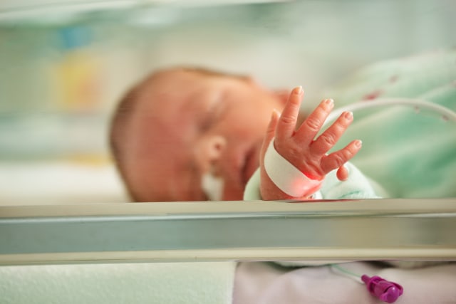 Ilustrasi bayi terlahir cacat. Foto: Shutterstock