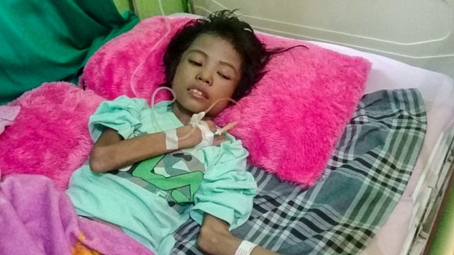 Kondisi Nur Aisyah yang menderita tumor otak. Foto: Awal Dion/Sulbar Kini