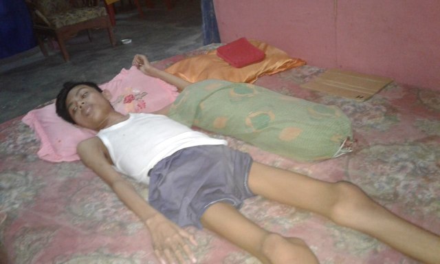 Raya Romantis Hartawan (20), pemuda asal Lampung Tengah didiagnosa mengalami penyakit TBC Tulang | Foto: Ist