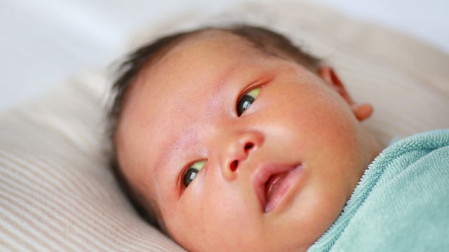 haruskah bayi yang alami jaundice atau 'kuning' tetap diberi ASI? Foto: Shutterstock 