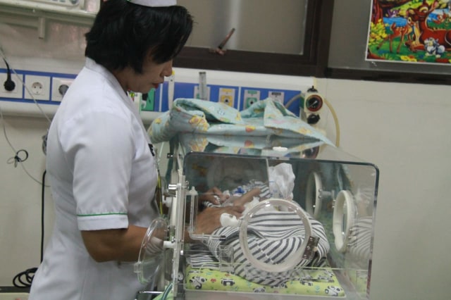 Bayi kembar parasit di RSUP Sanglah, Bali. Foto: Dok. Istimewa