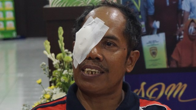 com-I Wayan Renasih, penderita katarak yang mendapatkan operasi katarak gratis dari Sido Muncul Foto: Maharani Sagita/kumparan