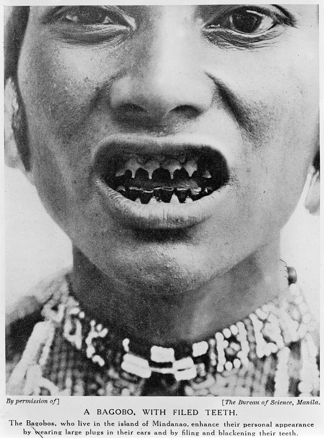 Tradisi meruncingkan gigi suku Bagobo di Filipina Foto: Wikimedia Commons