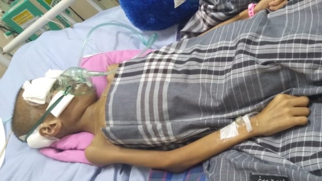 Nur Aisyah, anak pengidap tumor otak asal Majene dibantu dengan oksigen karena mengalami kesulitan bernapas. Foto: Dok. Istimewa